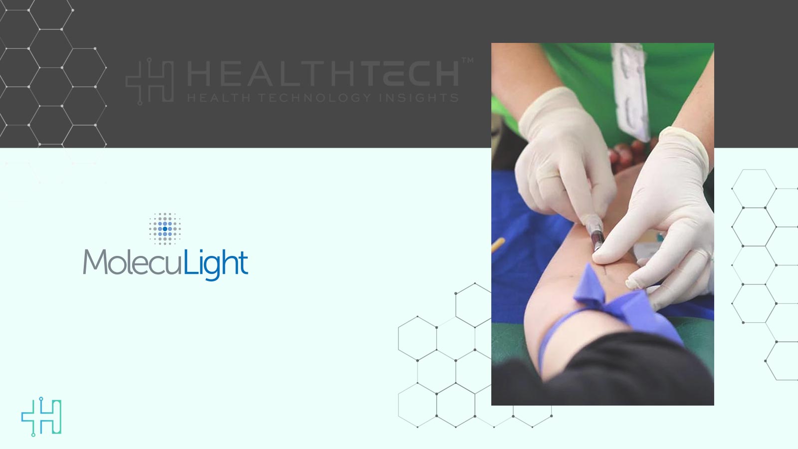 MolecuLight Secures $27.5 Million From Hayfin