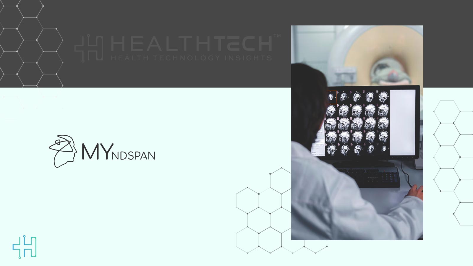 MYndspan and MEGIN Partner to Make Brain Scan More Accessible