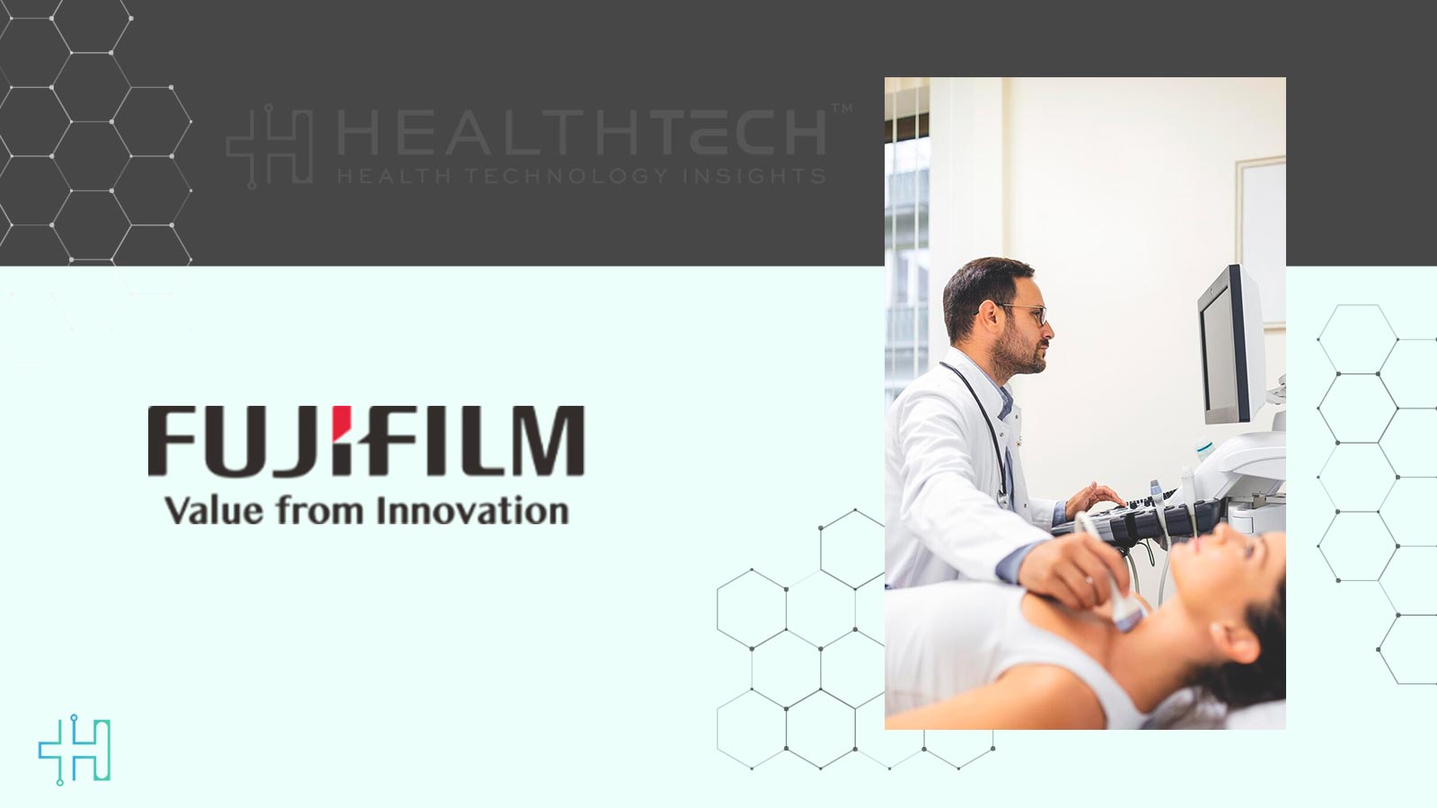 Europe-Wide Launch of Interventional Ultrasonic Endoscope