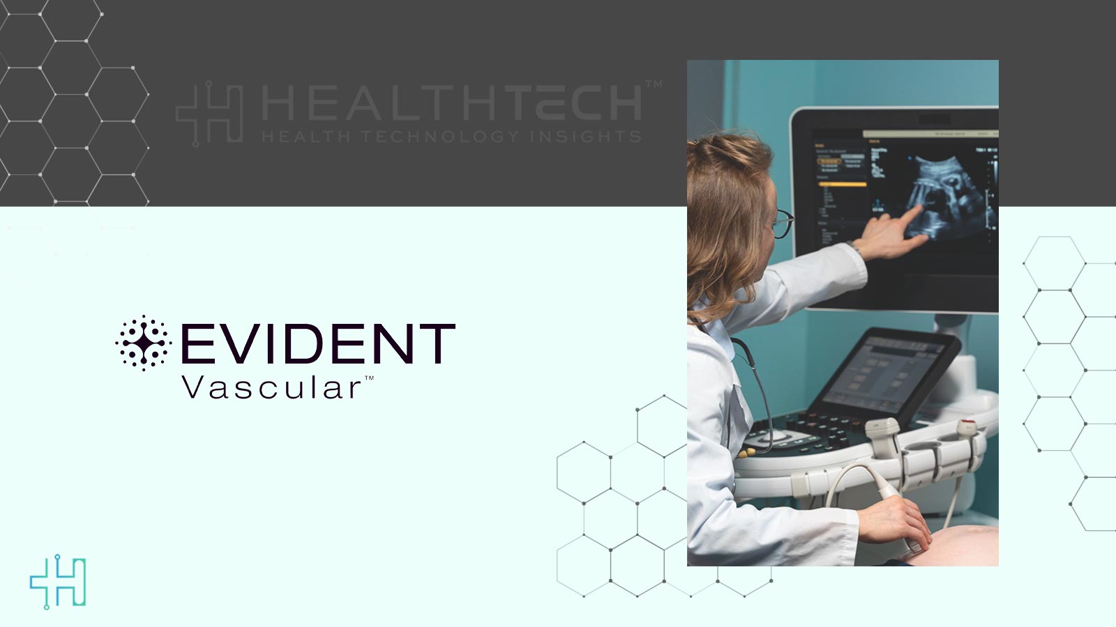 Evident Vascular Raises Series B to Advance AI Ultrasound Technology