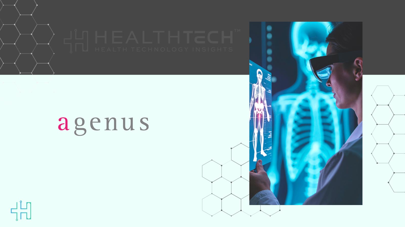 Agenus, Noetik Collaborate on AI Biomarkers for BOT/BAL Therapy