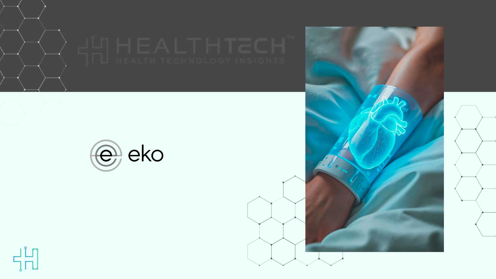 CMS Sets Payment Rate for Eko Health’s SENSORA in OPPS July 2025 Update