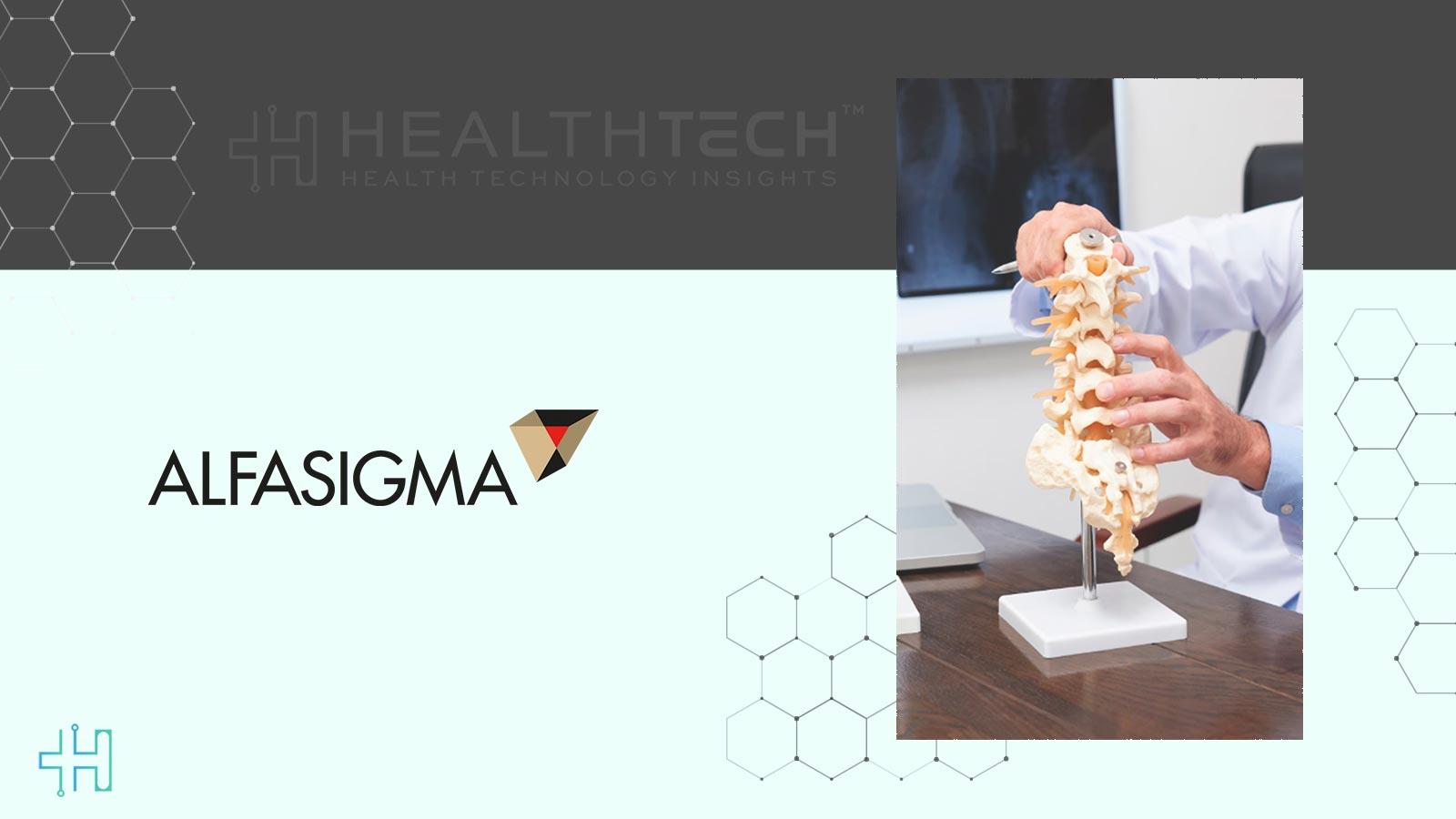 Filgotinib Shows Positive Results in Axial SpA Phase 3 Trial