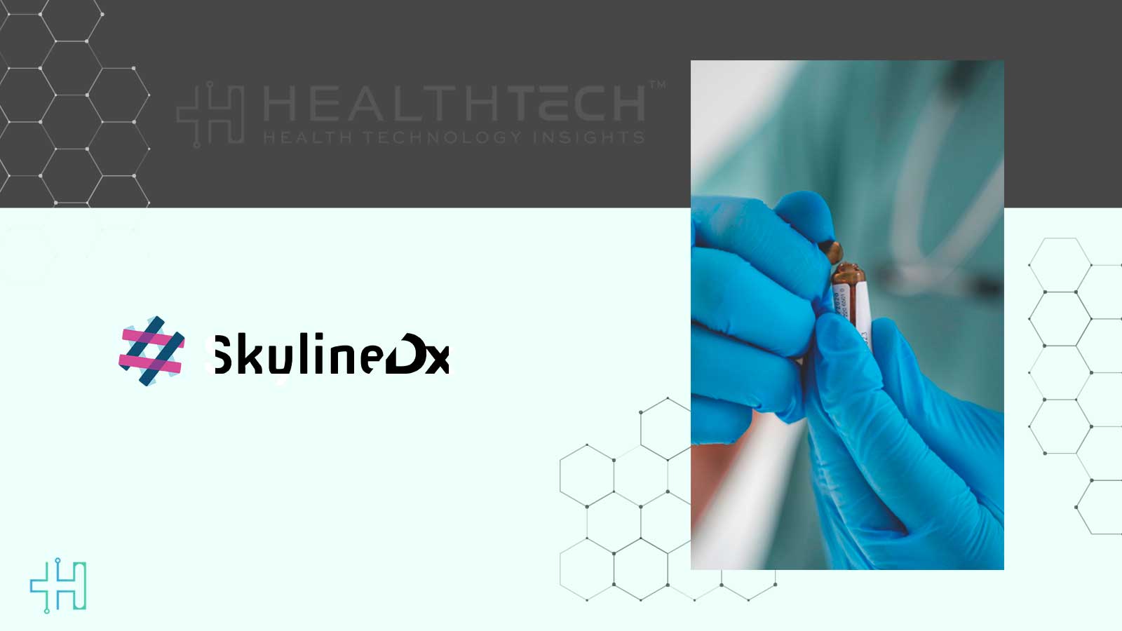 SkylineDx’s Merlin CP-GEP Test Proven Accurate for SLNB Selection