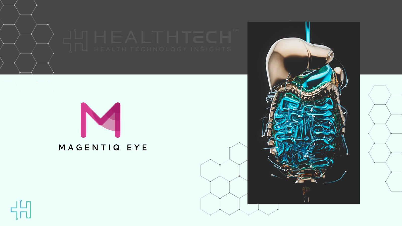 MAGENTIQ EYE Raises Series A Investment to Advance AI in Gastroenterology Care