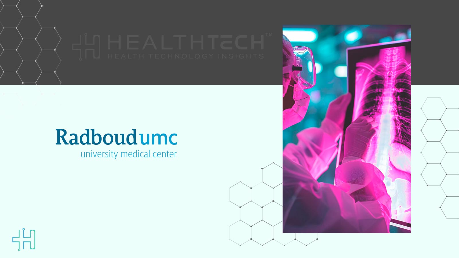 Dutch Screening Program Achieves Breast Cancer Detection with AI