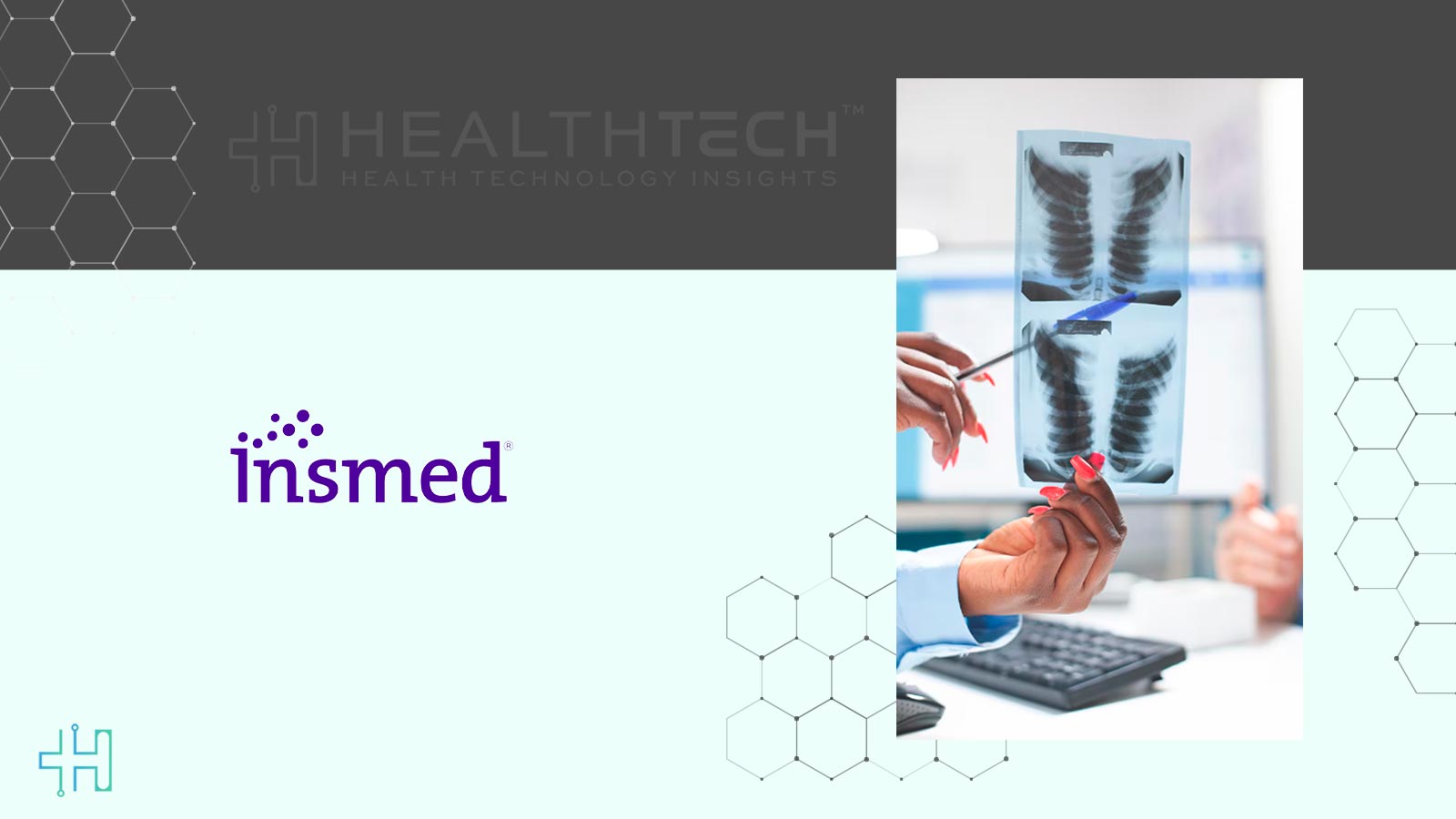 FDA Approves BRINSUPRI for Non-Cystic Fibrosis Bronchiectasis Treatment
