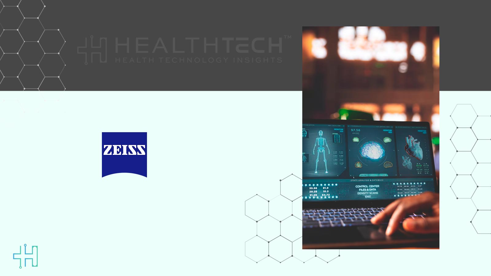 ZEISS CIRRUS PathFinder AI Gets CE Mark for OCT Analysis