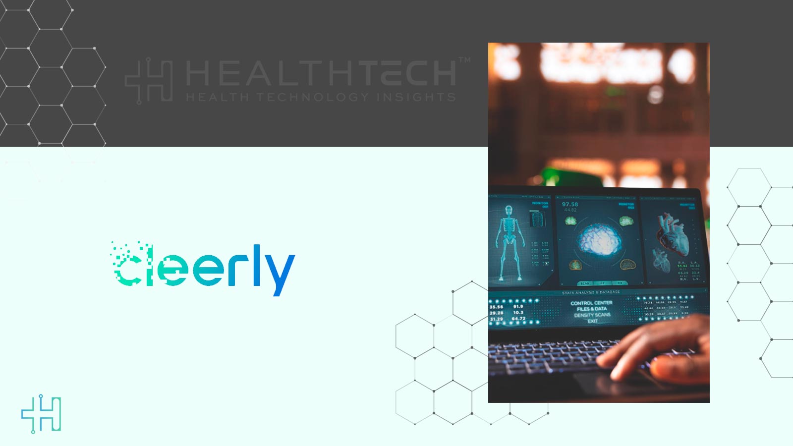 Cigna Approves Coverage for Cleerly's AI Cardiovascular Imaging Technology