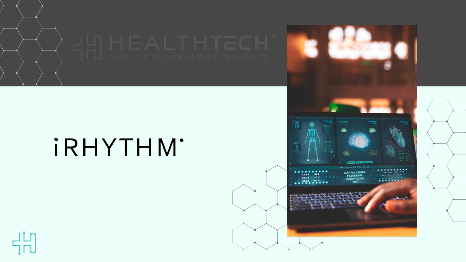 iRhythm and Lucem Health Partner for Early AI-Driven Arrhythmia Detection