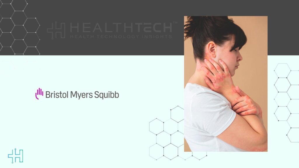 Bristol Myers Squibb Showcases Sotyktu Data in PsA and Lupus Studies