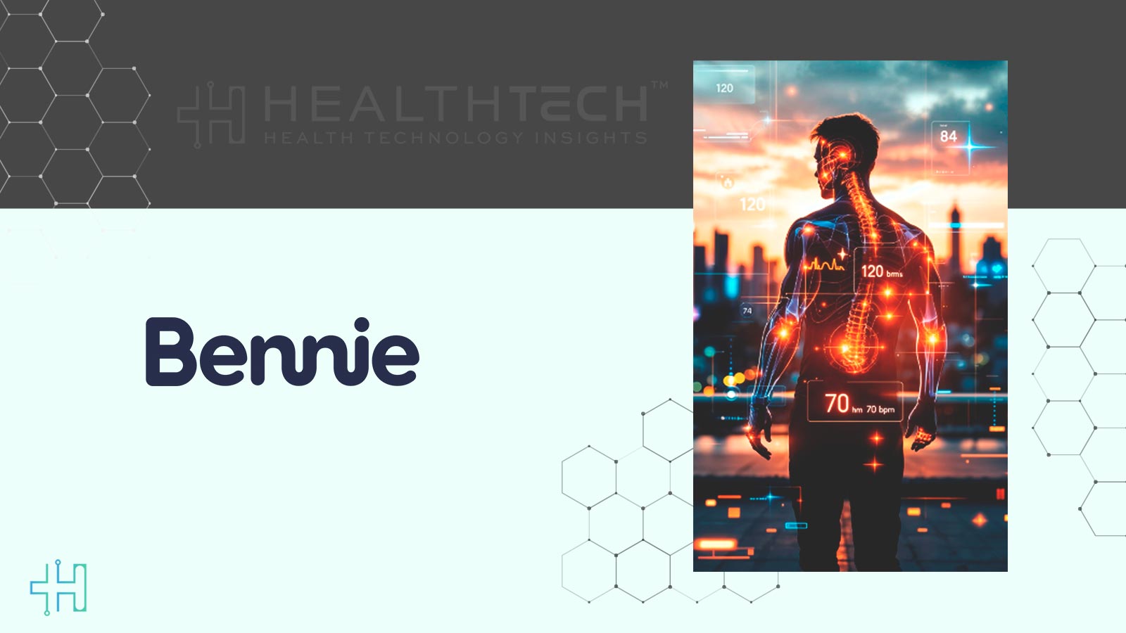 Bennie Secures $50Million from LNC Partners to Boost Growth