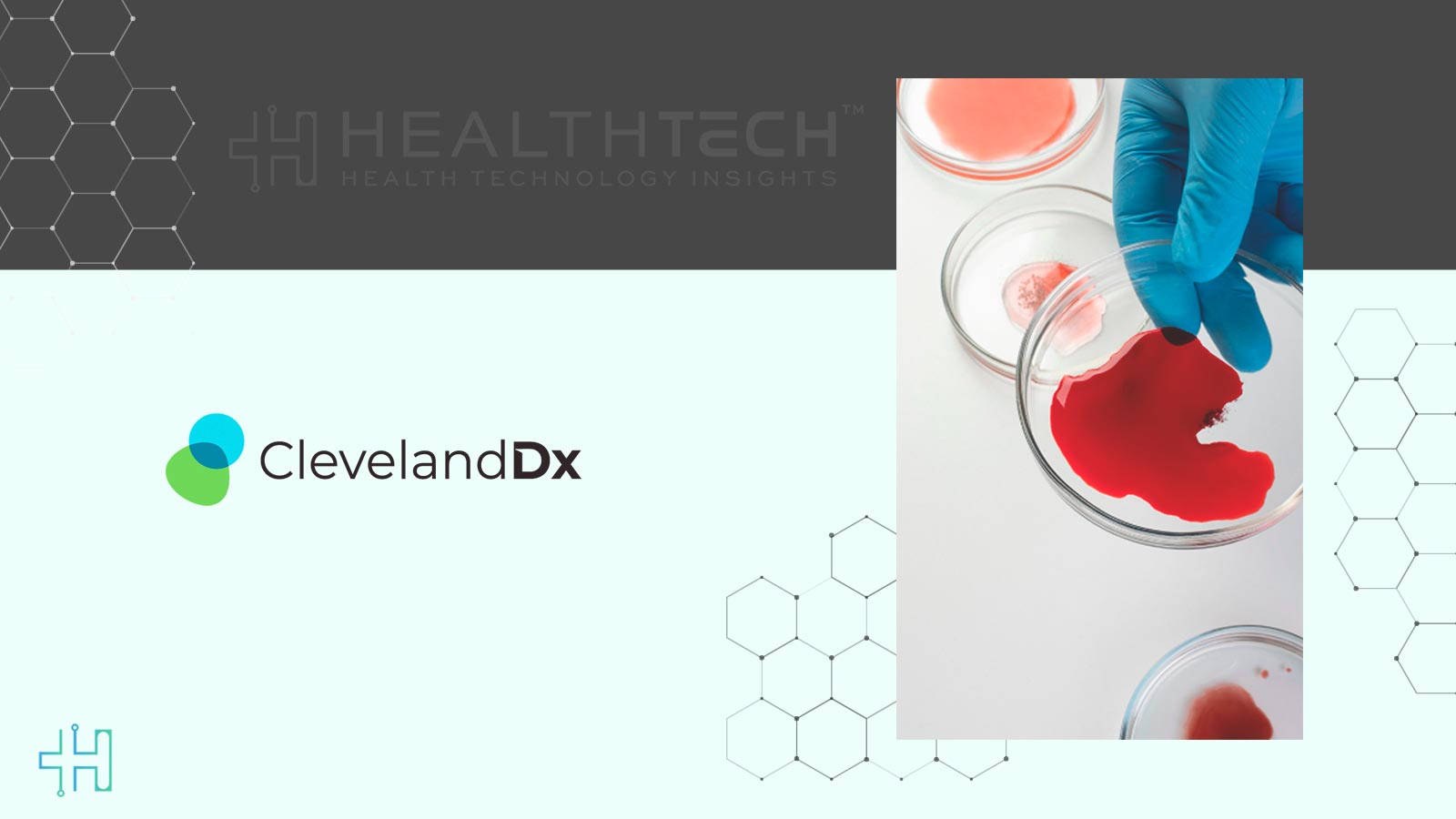 FDA Approves IsoPSA Cleveland Diagnostics’ Novel Blood-Based Prostate Cancer Test