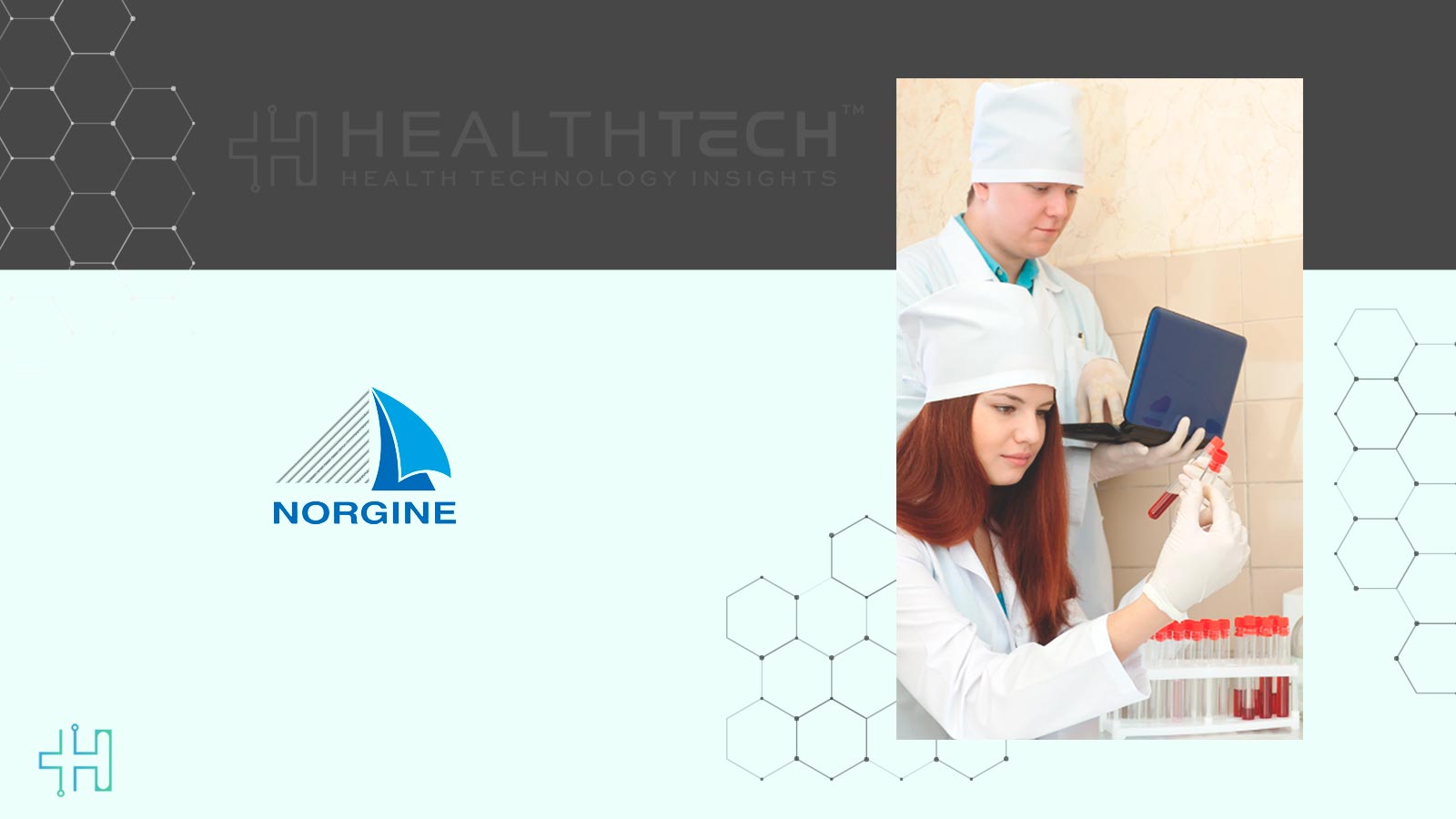 Norgine Expands Liver and Specialty Portfolio With Vir Biotechnology In-Licensing Agreement