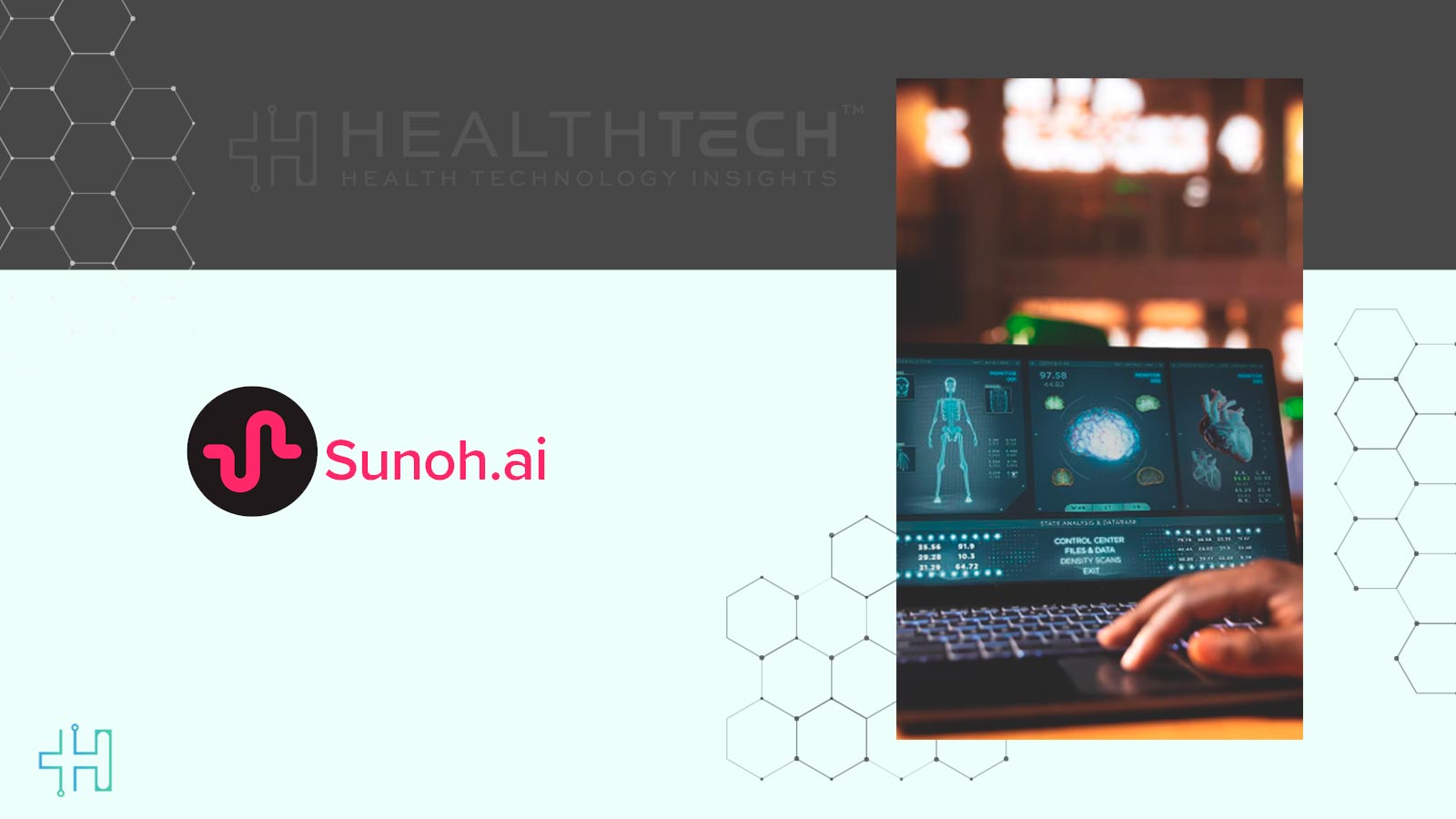 Sunoh.ai Joins athenahealth Marketplace for AI Documentation