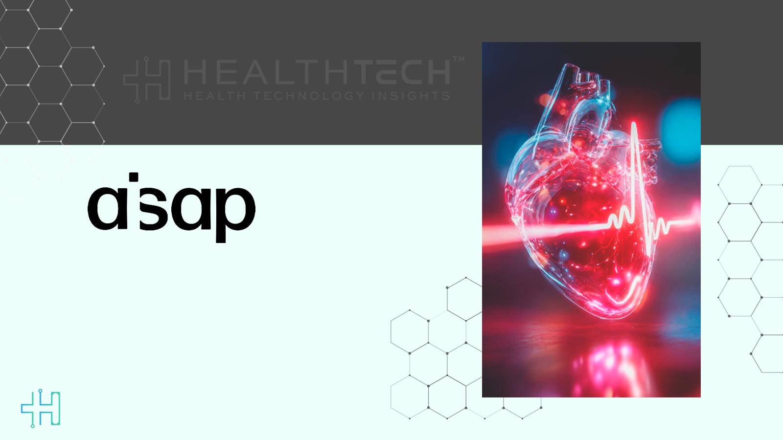 Study Confirms AISAP AI Can Detect Heart Disease from Ultrasound