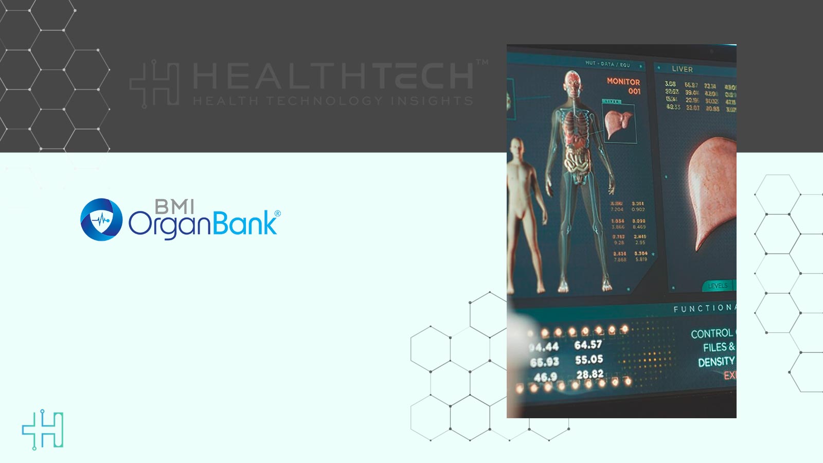 BMI OrganBank Shares Preclinical Data for Kidney Platform