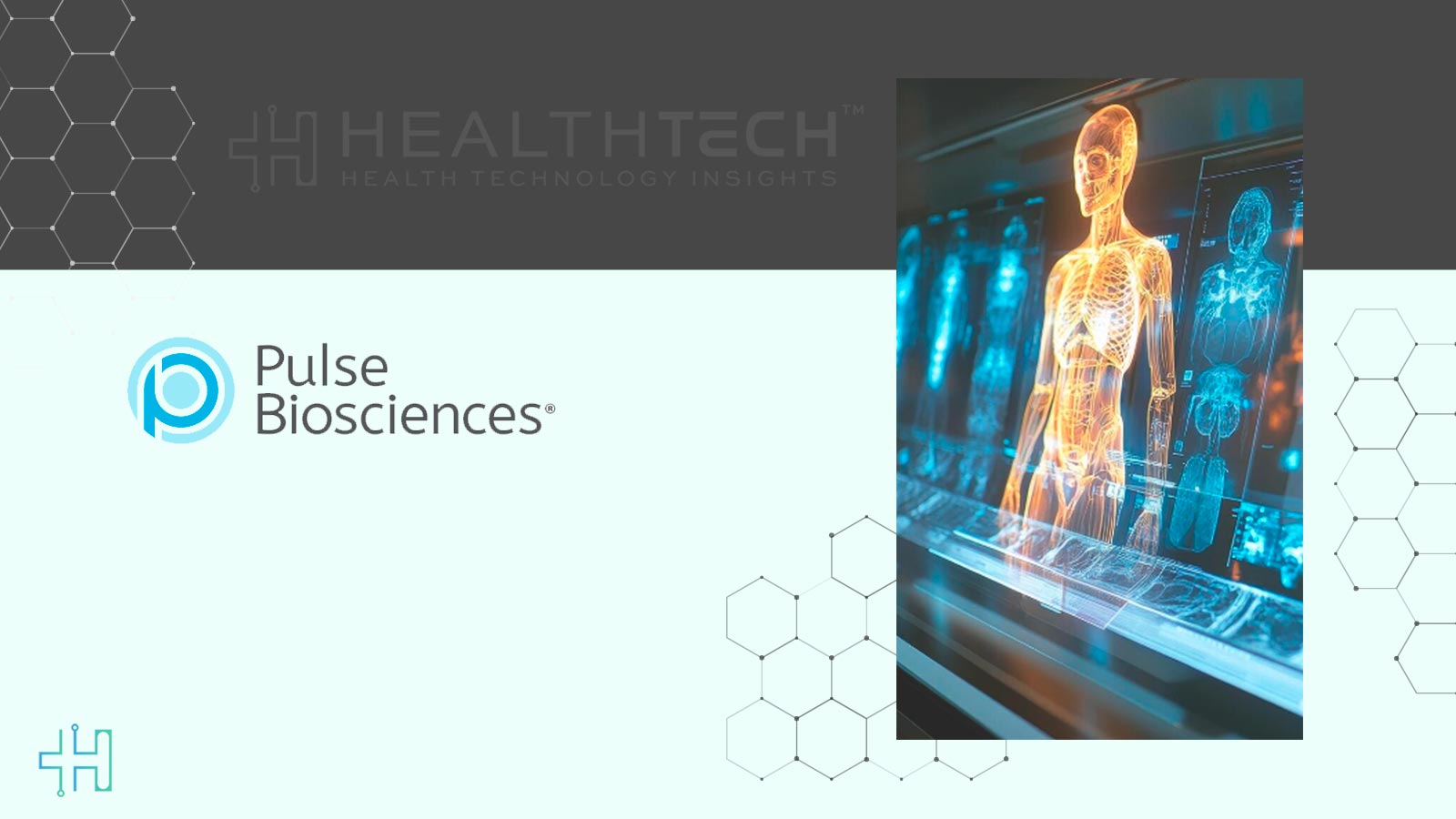 Pulse Biosciences Reveals nPulse Cardiac Study Data