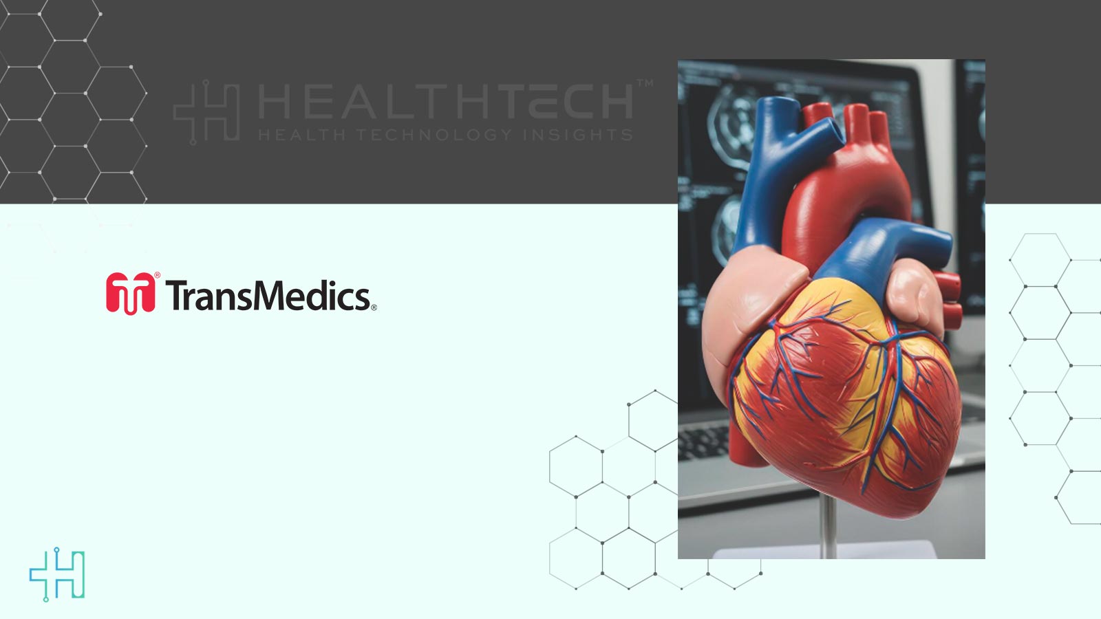 TransMedics Gets FDA IDE Approval for OCS Heart ENHANCE Trial
