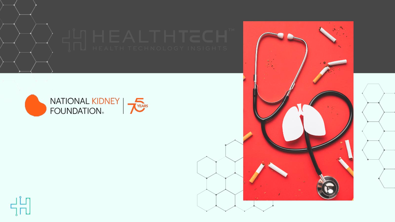 5 Kidney Disease Facts to Know Before World Kidney Day